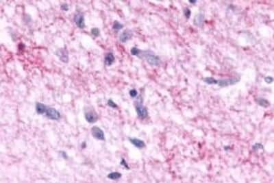 Immunohistochemistry: Melatonin R1A/MT1/MTNR1A Antibody [NBP3-14399]